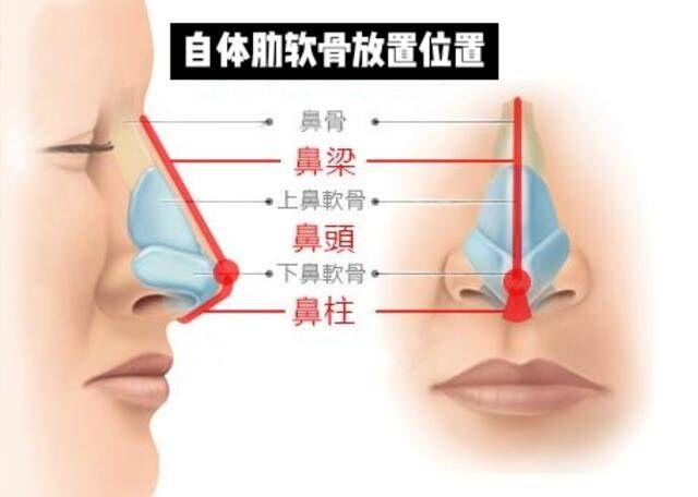 鼻子美不美决定权在山根还是鼻部曲线