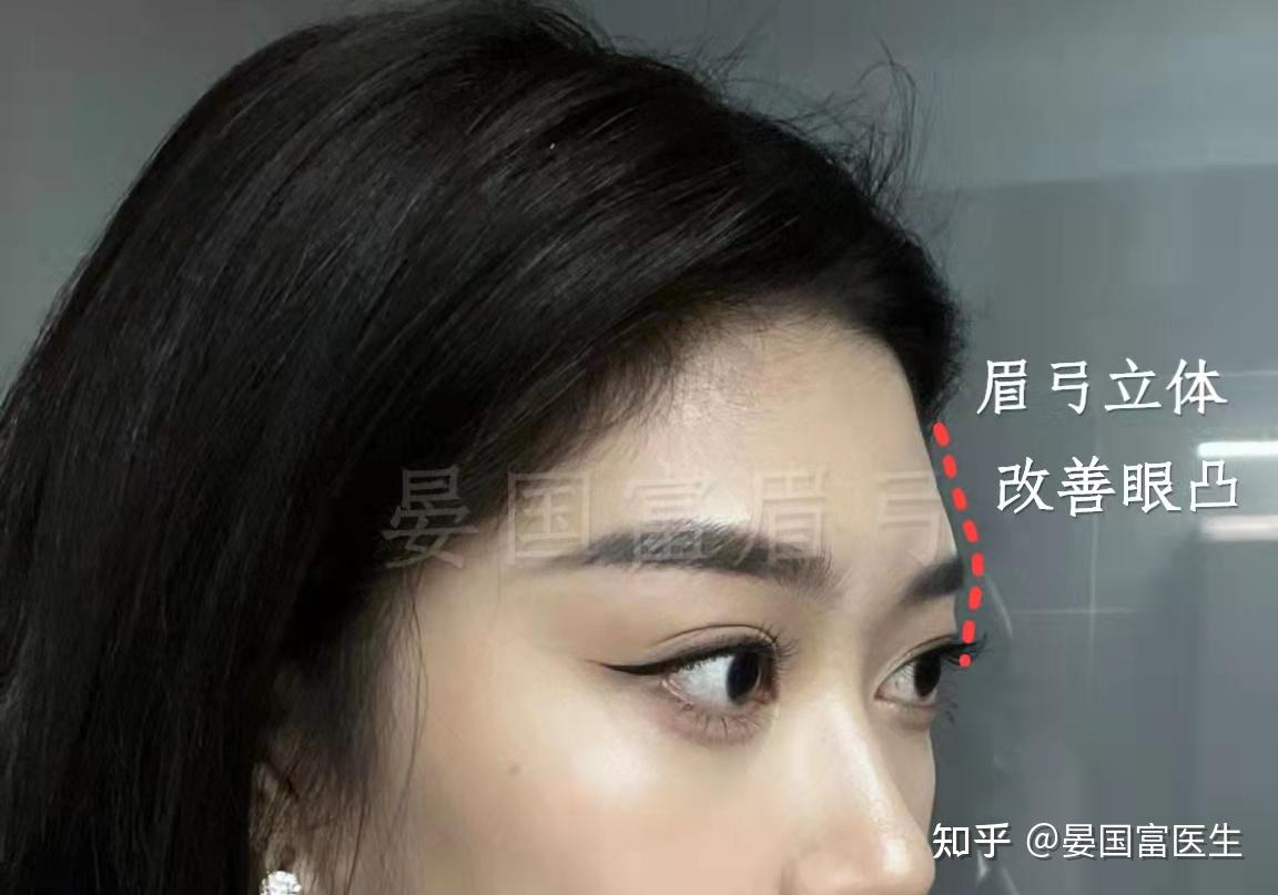 眉弓指的是哪里?有什么作用?你有吗? - 知乎