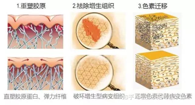 这些情况不能进行激光祛疤治疗你知道吗