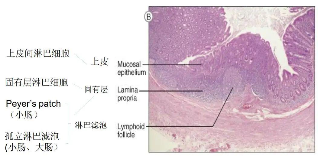 膀胱固有层图片