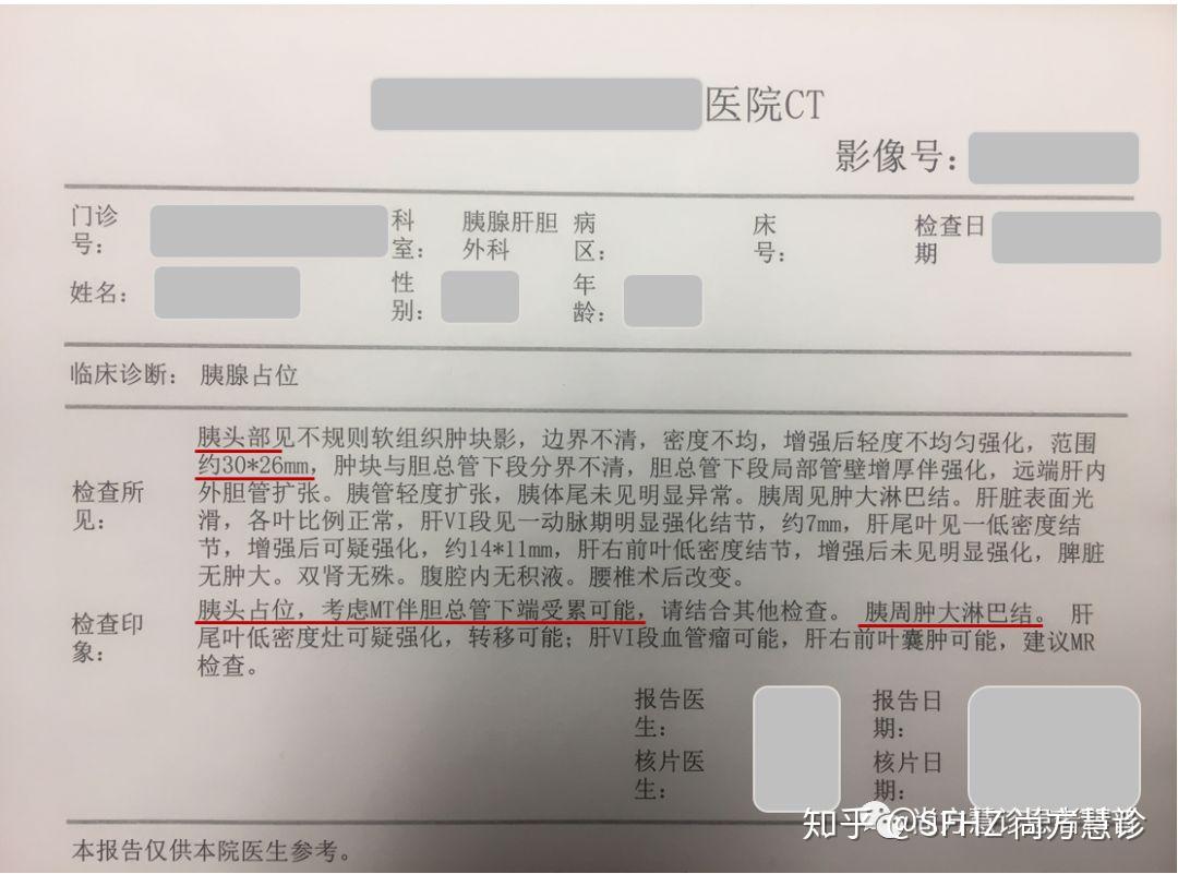 可切除胰腺癌ct示例,临床分期iib,关键信息如下:原发肿瘤:胰头部肿块