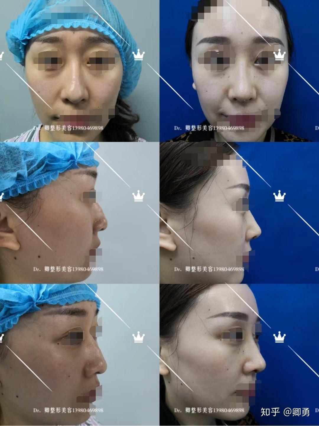 上海九院毕业做隆鼻好看的整形医生-变美网-了解日本美容美妆资讯