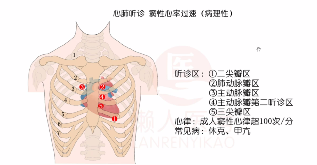 肺动脉瓣听诊区的位置图片