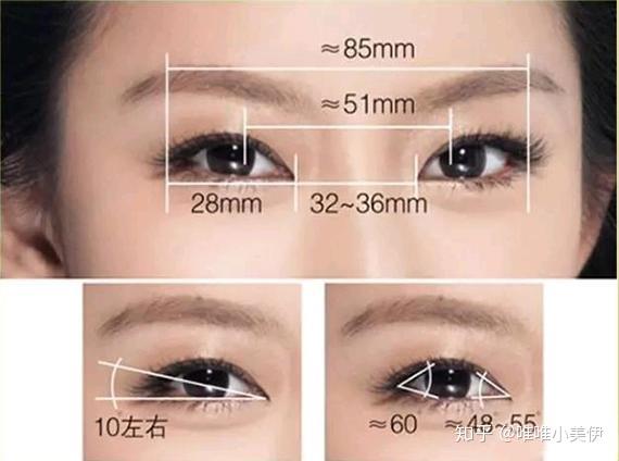 眼距宽怎么改善?