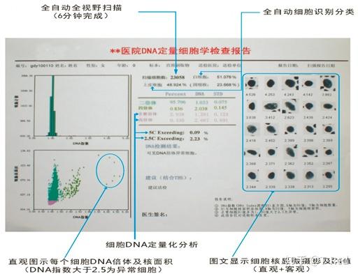 Dna倍体 宫颈癌检测 知乎