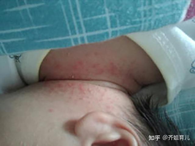 几个月会有惊跳反射 v2-4111ab27464347264007b3abf7074aa2_r.jpg