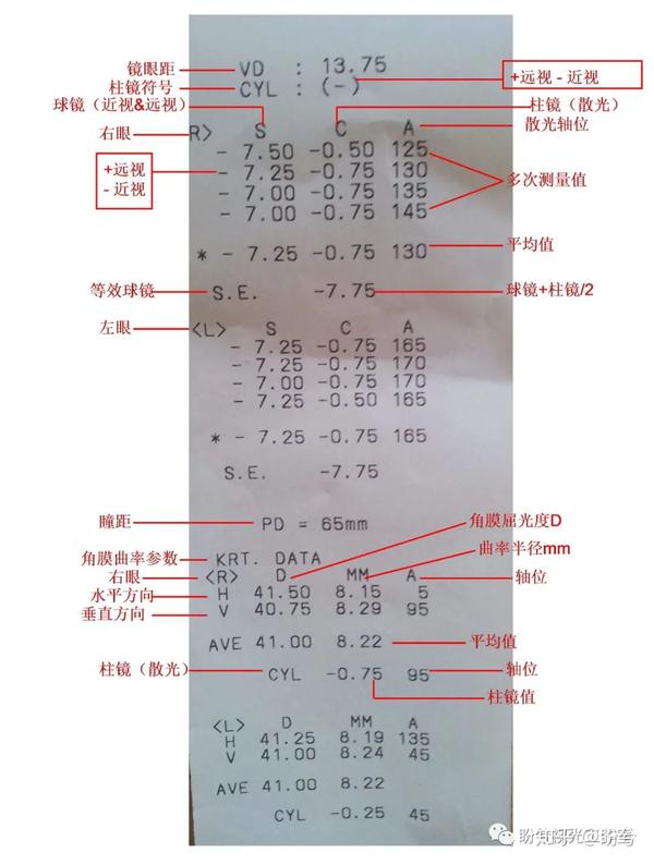 球镜度数对照表图片