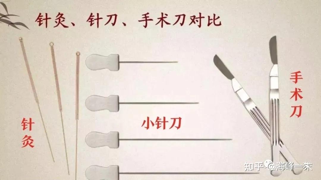 针灸火针针刀齐上阵,我的颈椎病希望这次还有的救! - 知乎