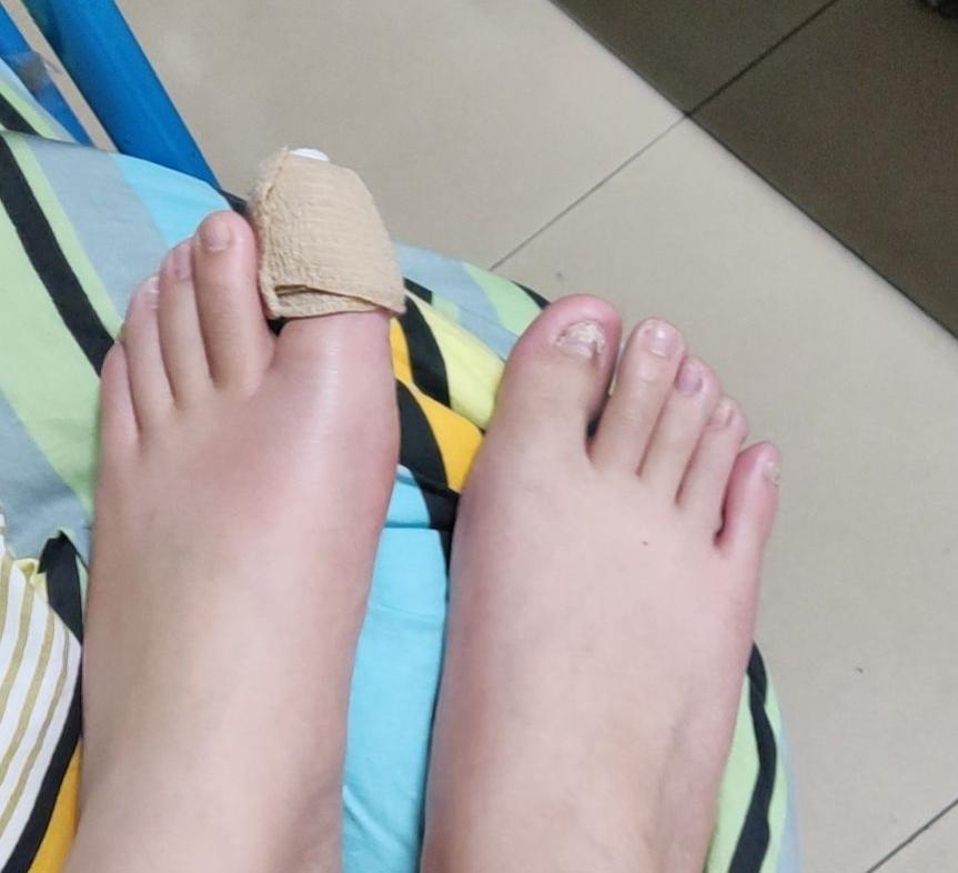 4    做完手术回来,医生让买止痛药,差不多了吃,买的塞来昔布胶囊