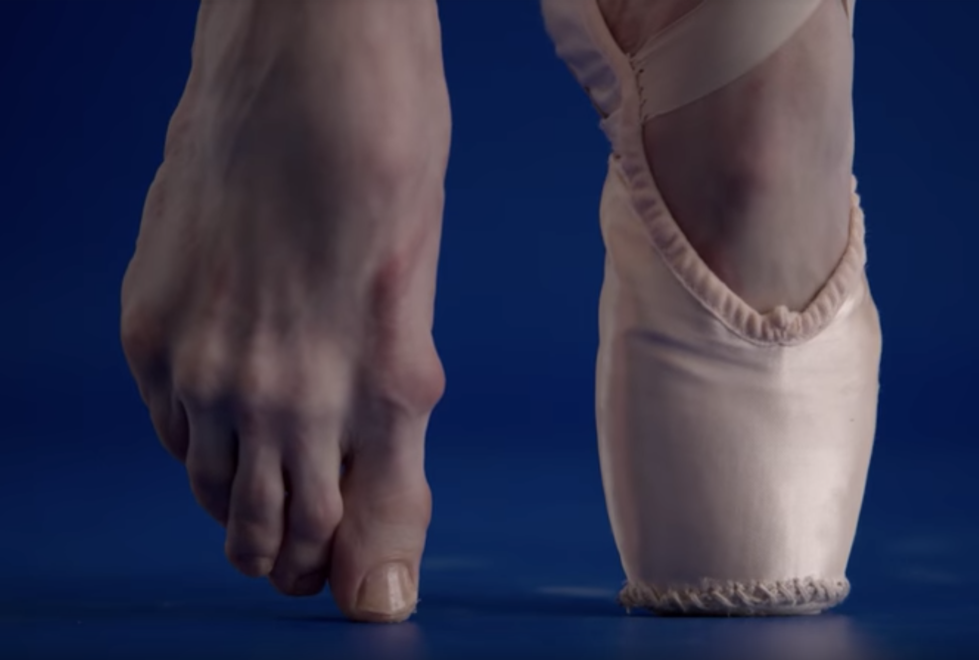 芭蕾舞者的脚在足尖鞋里是什么样子的