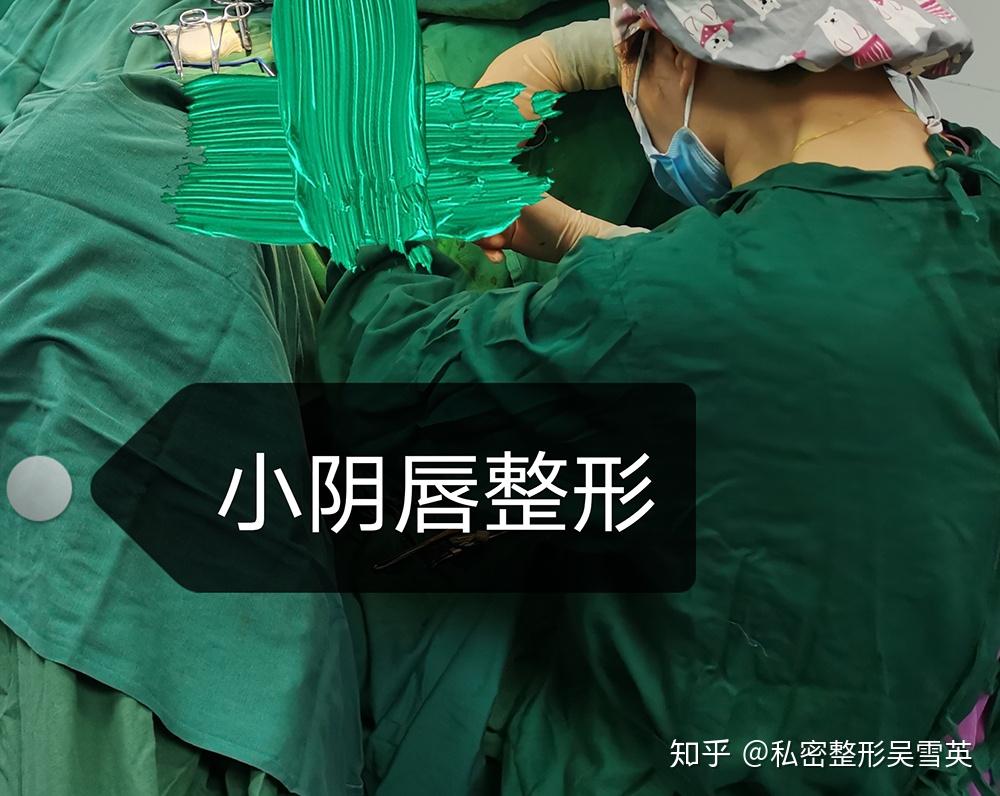 【小阴唇整形案例】左右不对称,就要手术吗?