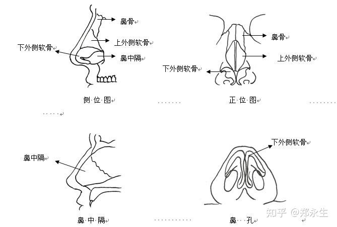 鼻根,鼻梁部分的鼻骨,属于骨性结构,结构稳固质地坚硬,一般的揉捏和鼻