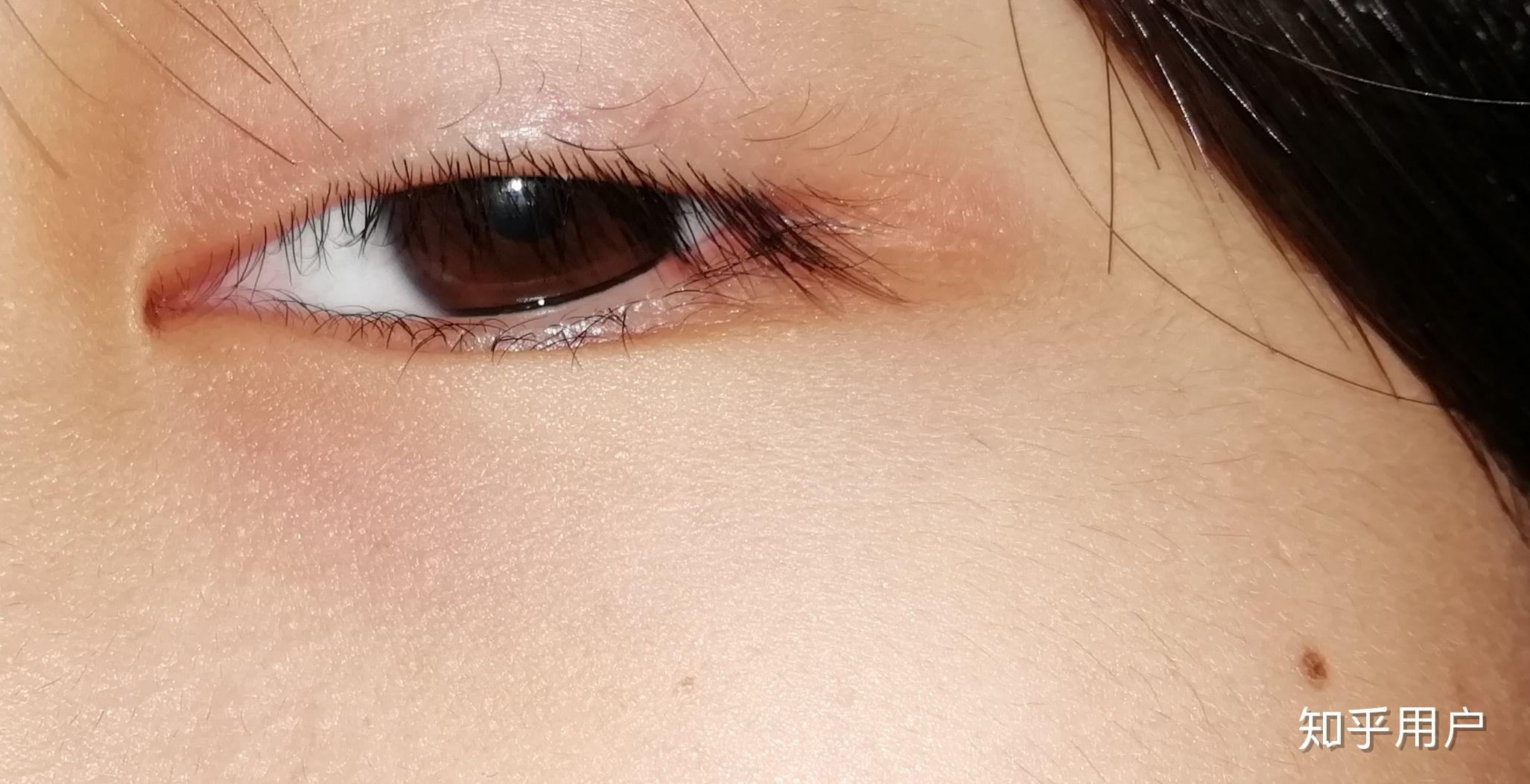 有一单一双的眼睛是啥样