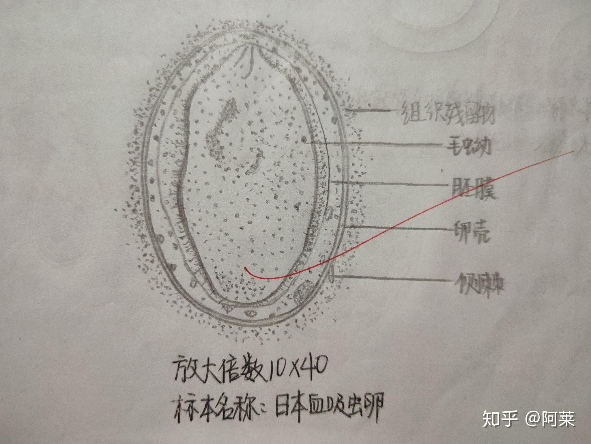 肺吸虫卵铅笔手绘图图片