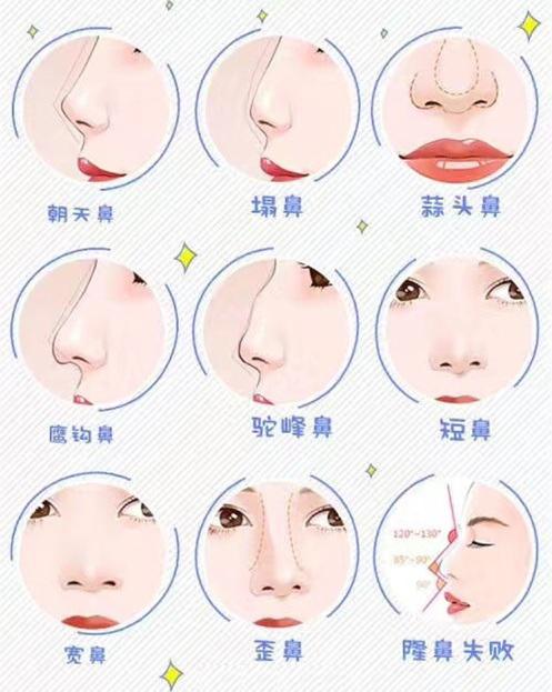 什么样的鼻子 zhuanlan.zhihu.com