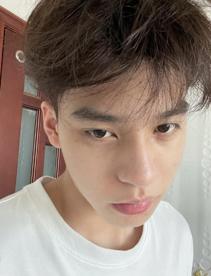 男生怎么在短时间内去除痘痘和痘印拥有好皮肤