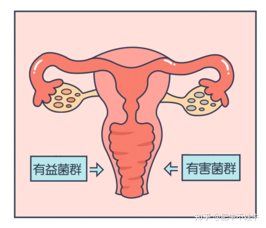 女人私处有炎症,80%都跟这个东西有关 - 知乎