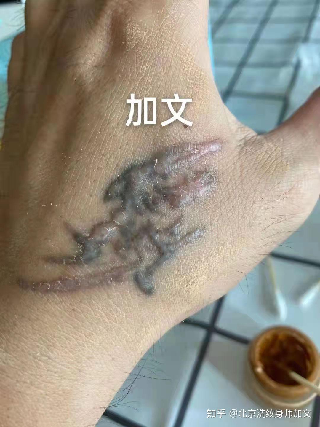 洗纹身是种什么样的体验？ - 知乎