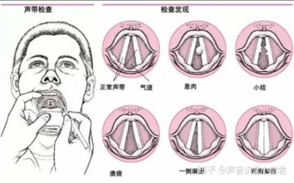 声音整形是什么鬼?深扒声音整形的秘密! - 知乎