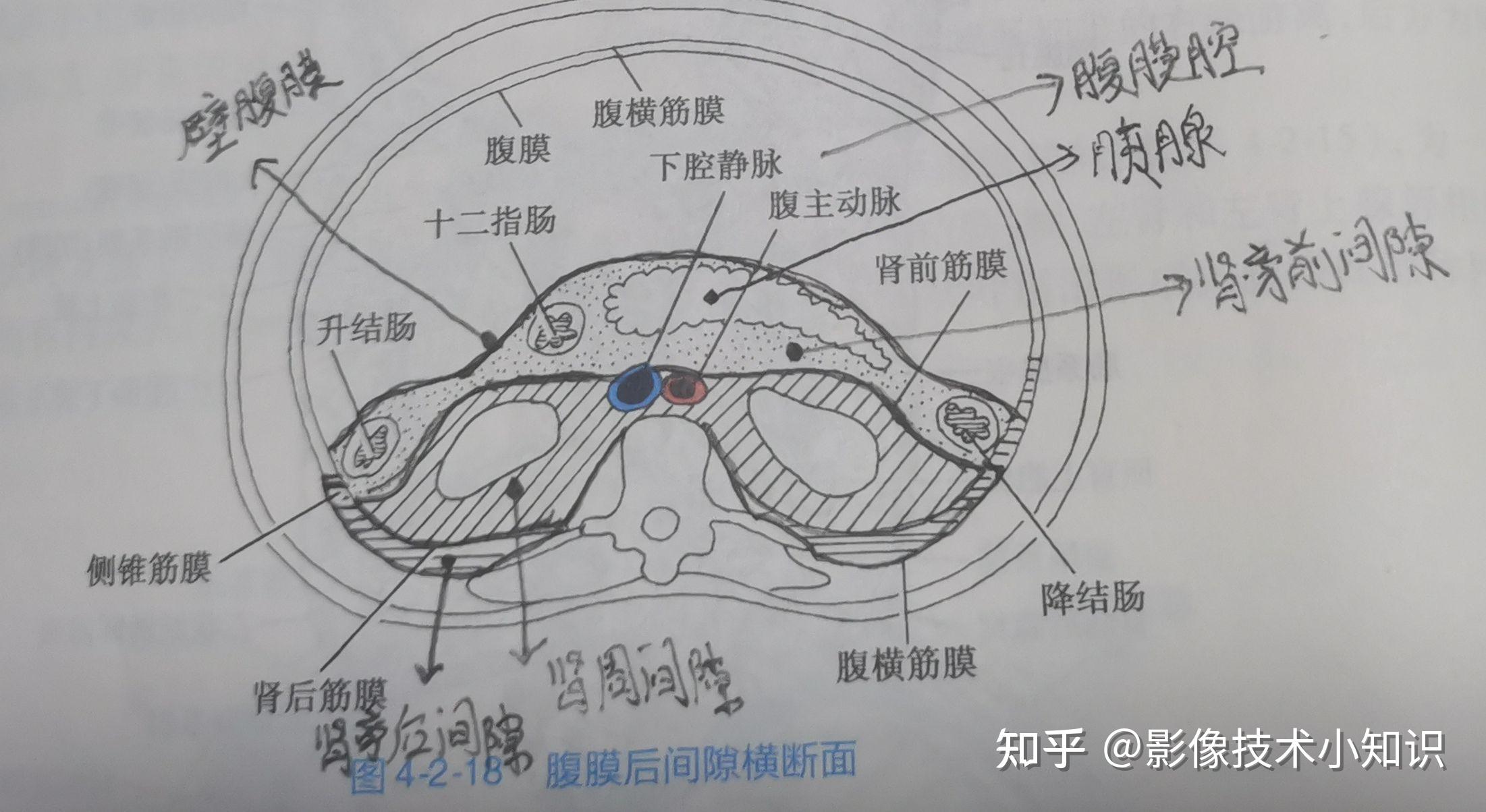 胰腺影像解剖 - 知乎