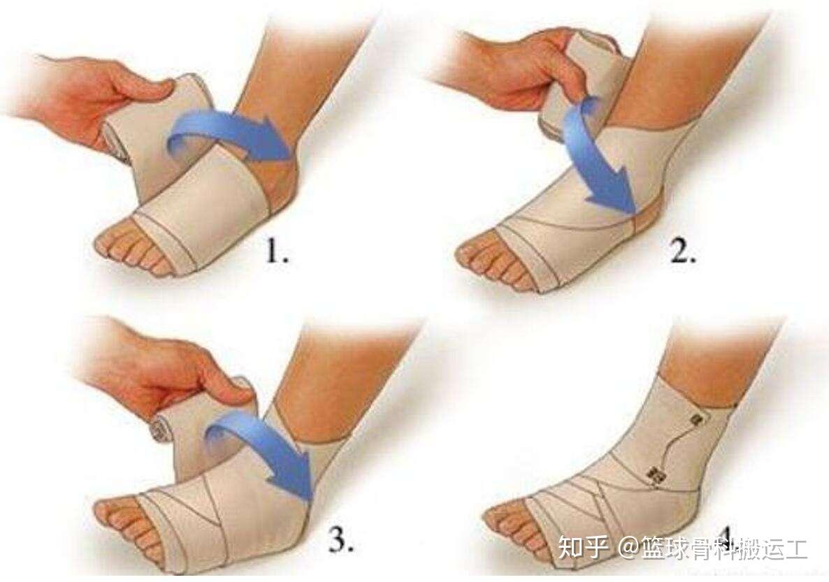 还以为崴脚了没事?---骨科医生教你应对踝关节扭伤 - 知乎
