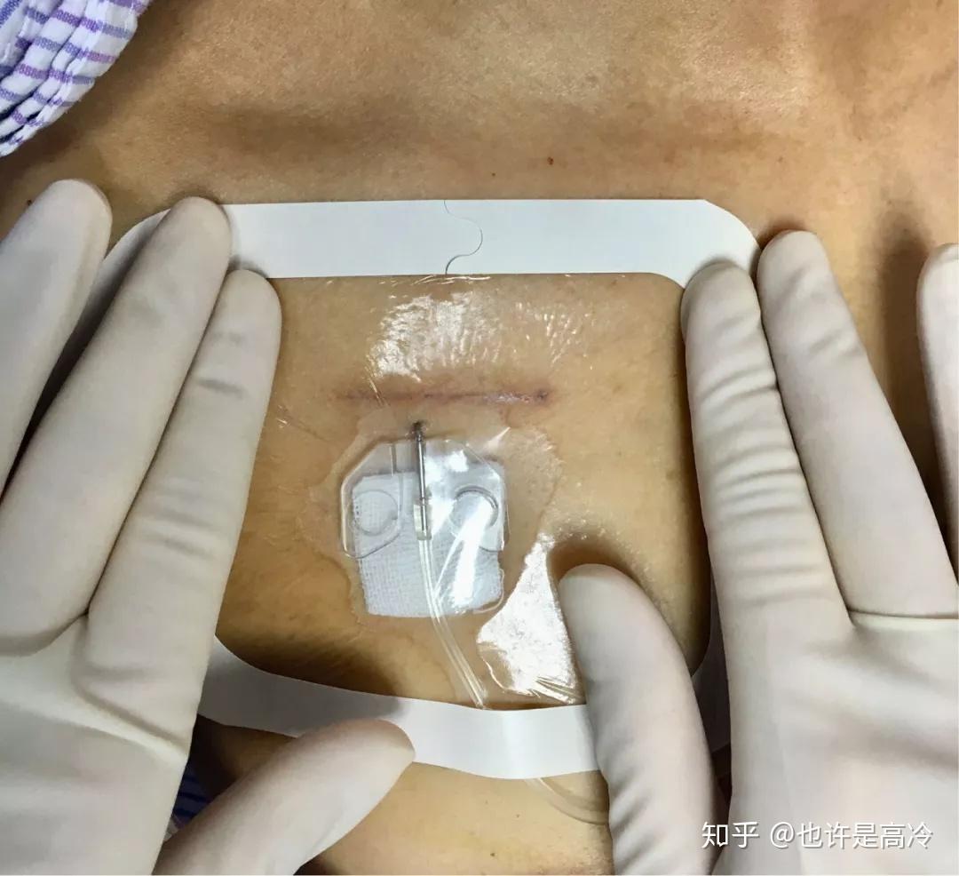 如何才能不怕针扎 v2-44825001fda8399ba00250f56859ea81_r.jpg