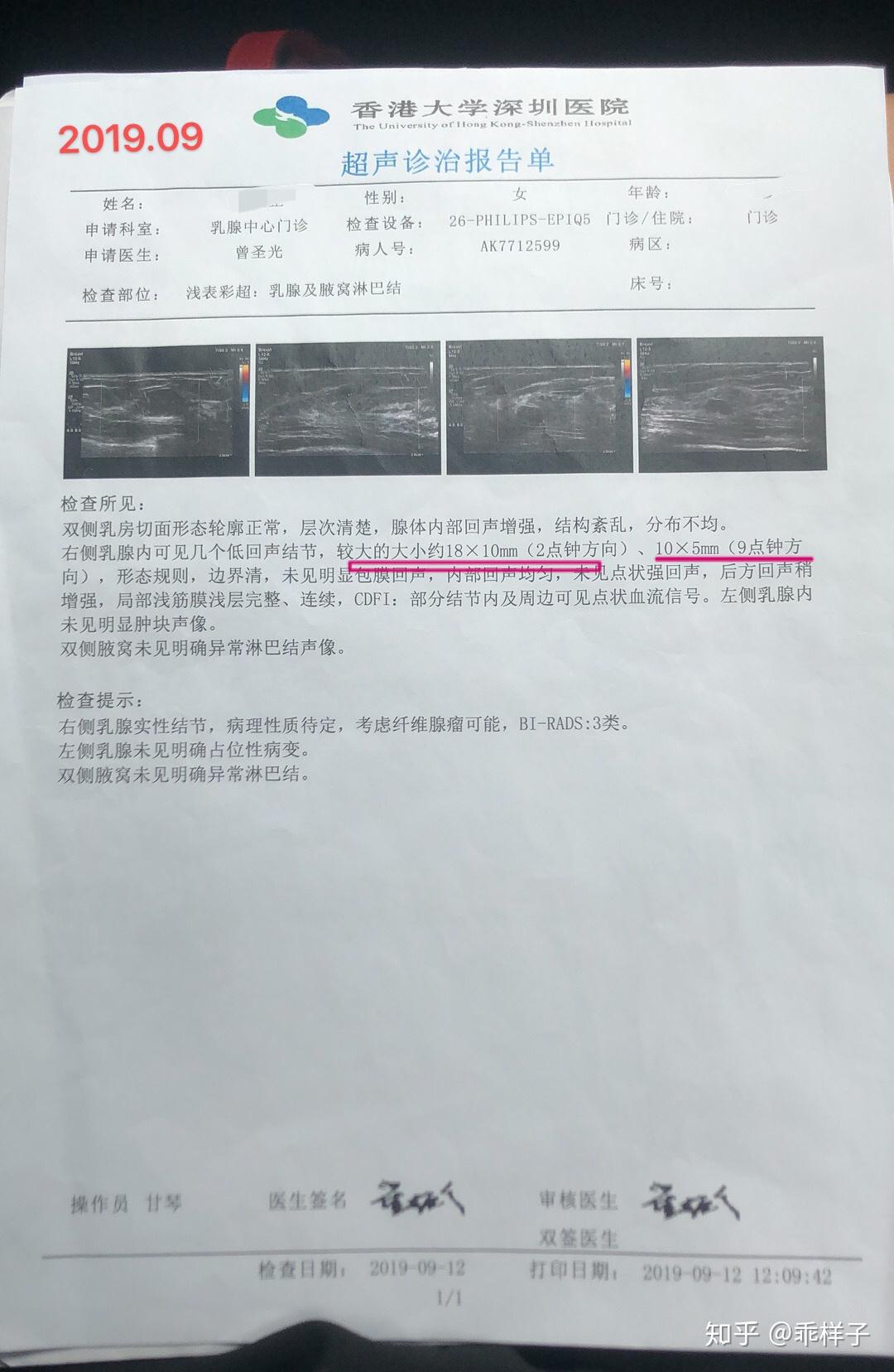 乳腺纤维瘤4a级我怎么办