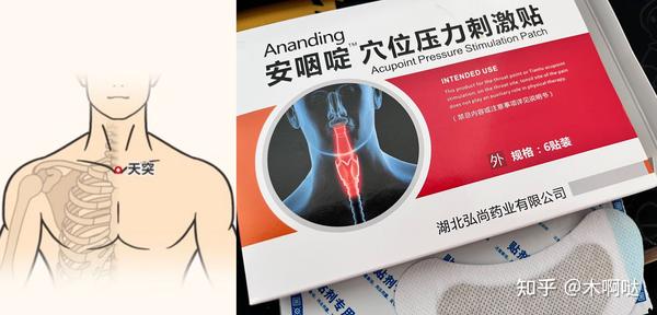 慢性咽炎挂什么科?耳鼻喉?内科? - 知乎