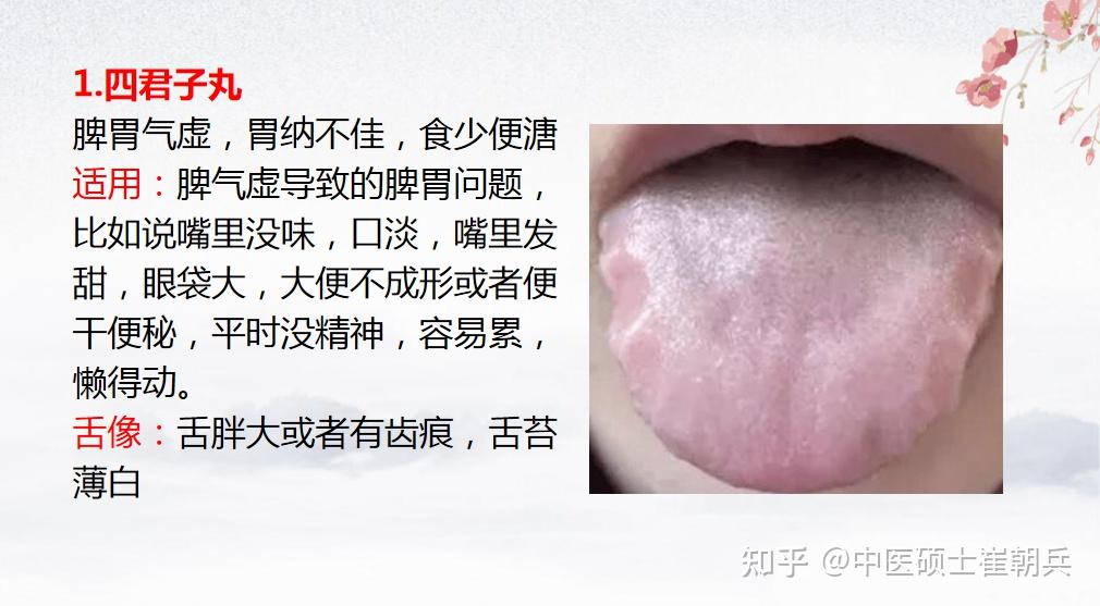 脾虚百病生!一舌一病,一症一药,中成药大分享 - 知乎