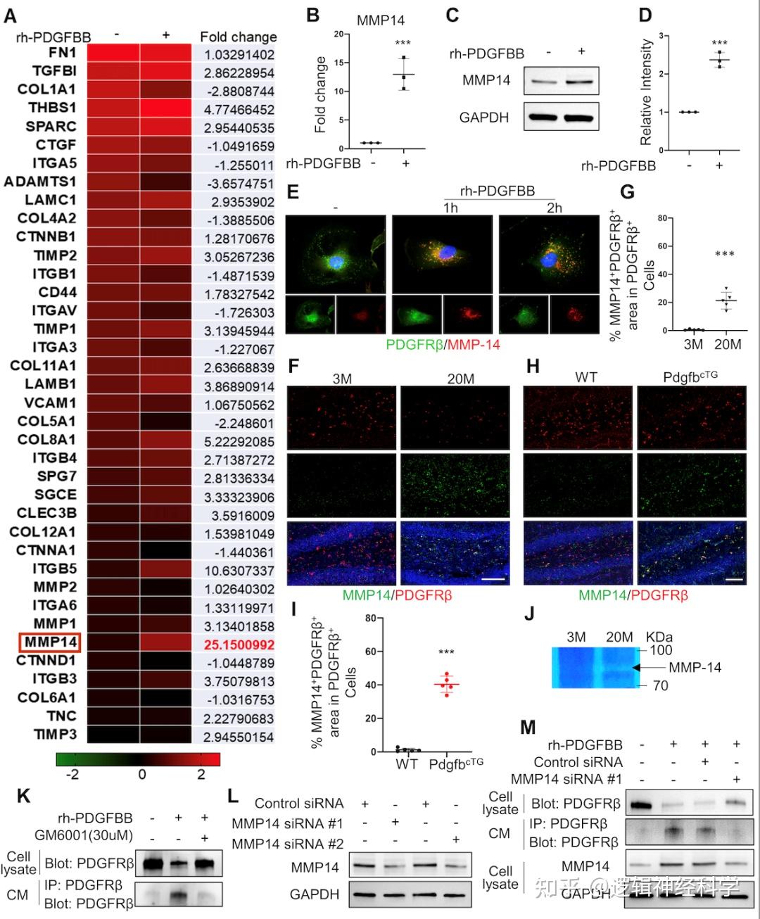 约翰斯霍普金斯大学团队发现衰老骨分泌PDGF-BB可通过剪切周细胞中PDGFRβ导致大脑海马区血管损伤 - 知乎
