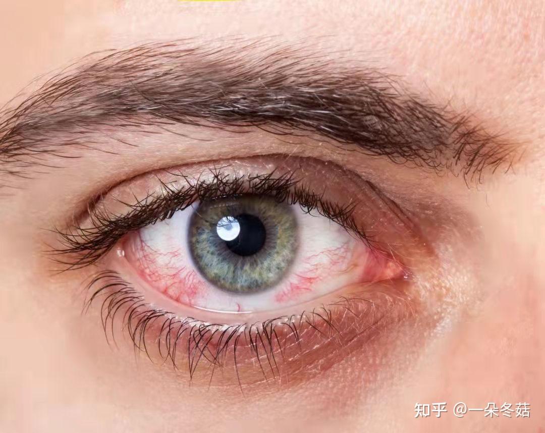 眼睛出现不适和疼痛，或是这3个原因引起的，需及时检查病因