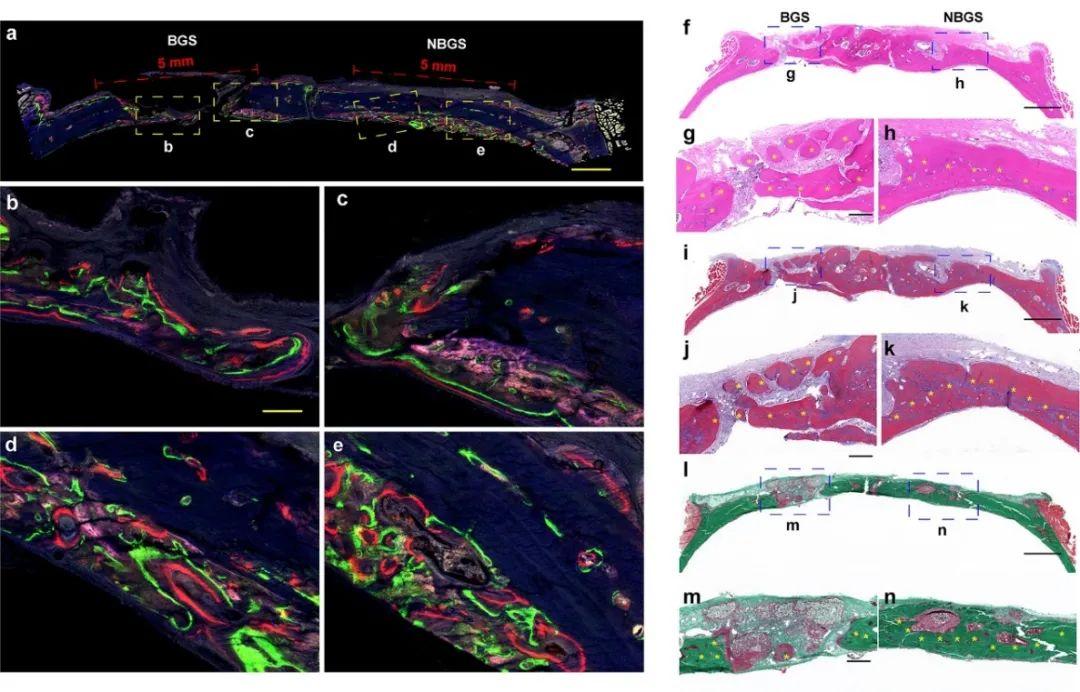 新生骨荧光成像和组织学染色.