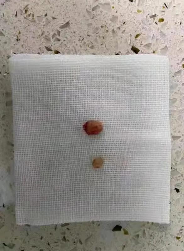 如何正确快速和猫咪膀胱结石saygoodbye