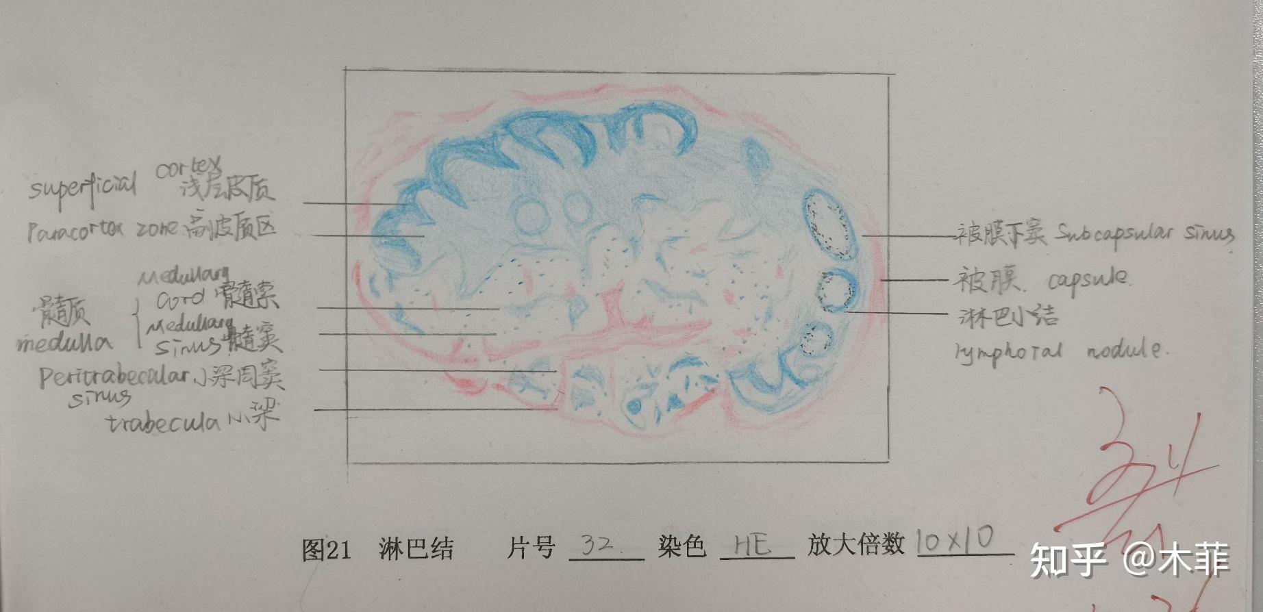 淋巴母细胞红蓝铅笔图片