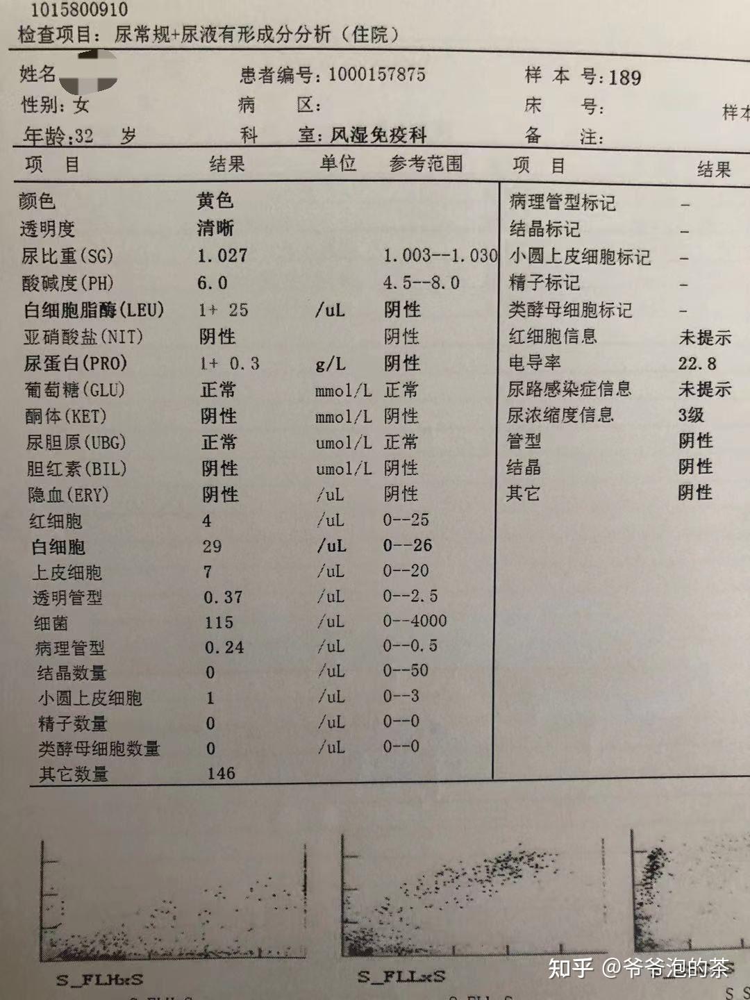 红斑狼疮中医治疗效果试验
