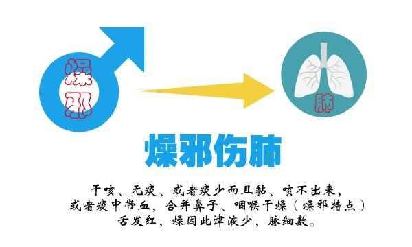 咳嗽药那么多,是不是吃哪个都一样?