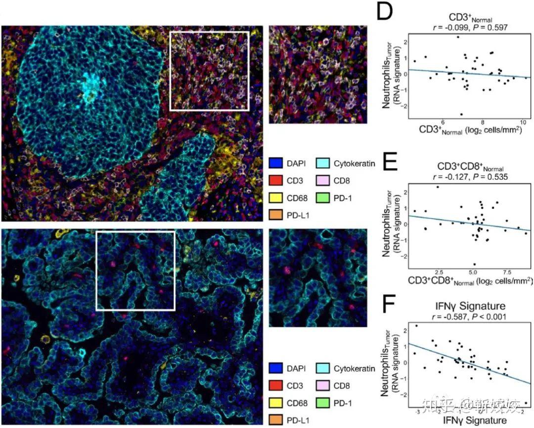 Dapi Cd8 Phenoptics多色定量病理微环境分析方案—2020年半年经典应用案例赏析 - 知乎