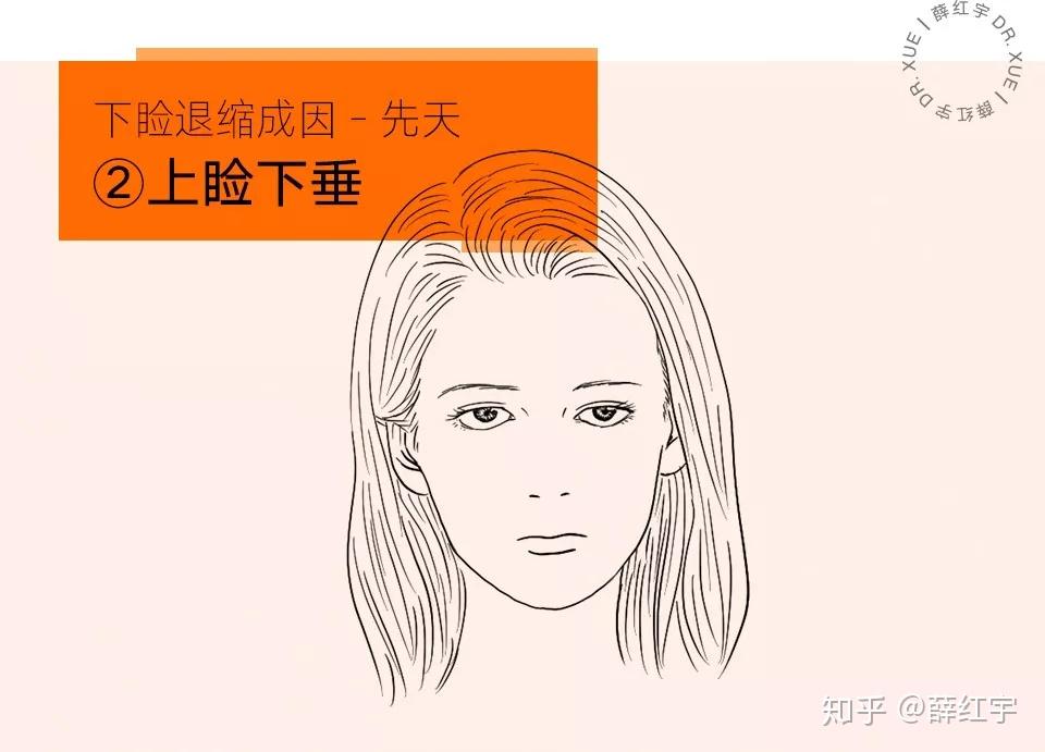 三白眼怎么办? - 知乎