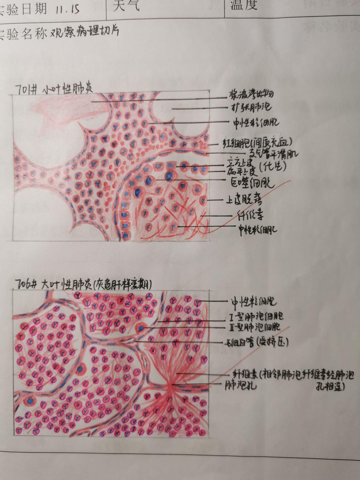 肺呼吸部红蓝铅笔绘图图片