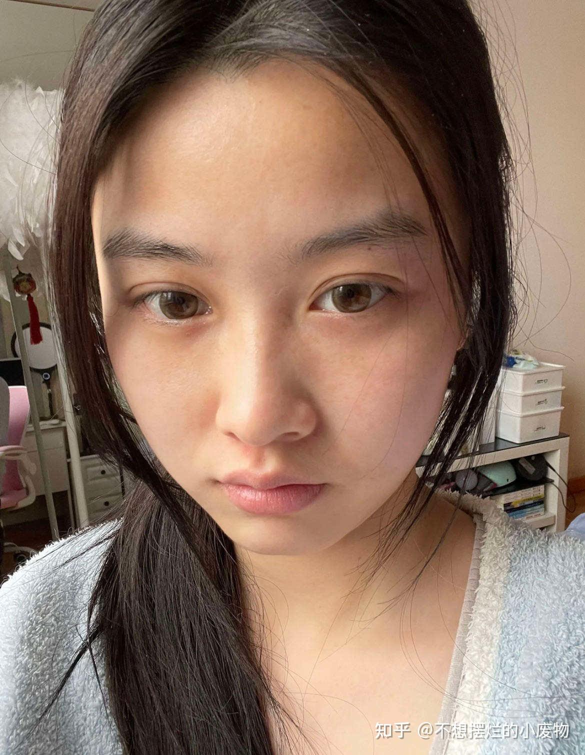 长期熬夜皮肤变得暗黄又粗糙,到底该怎么挽救啊?