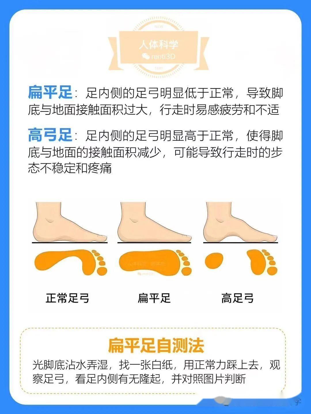 【步态评估】走路姿势太难看，一图看懂常见足部步态问题 - 知乎