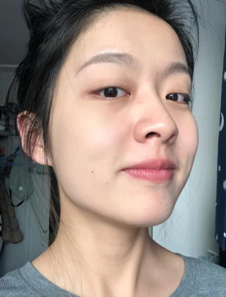 细纹多皮肤松弛蜡黄的女生是如何保养好的