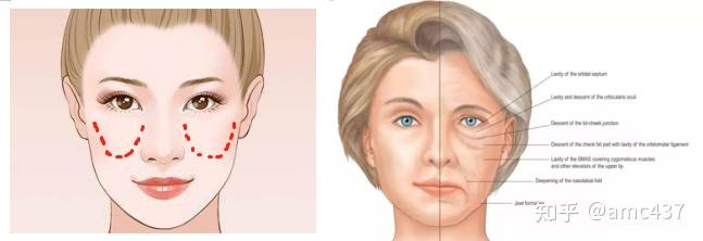 面中扁平就一定不好看吗面中凹陷的四个变美思路