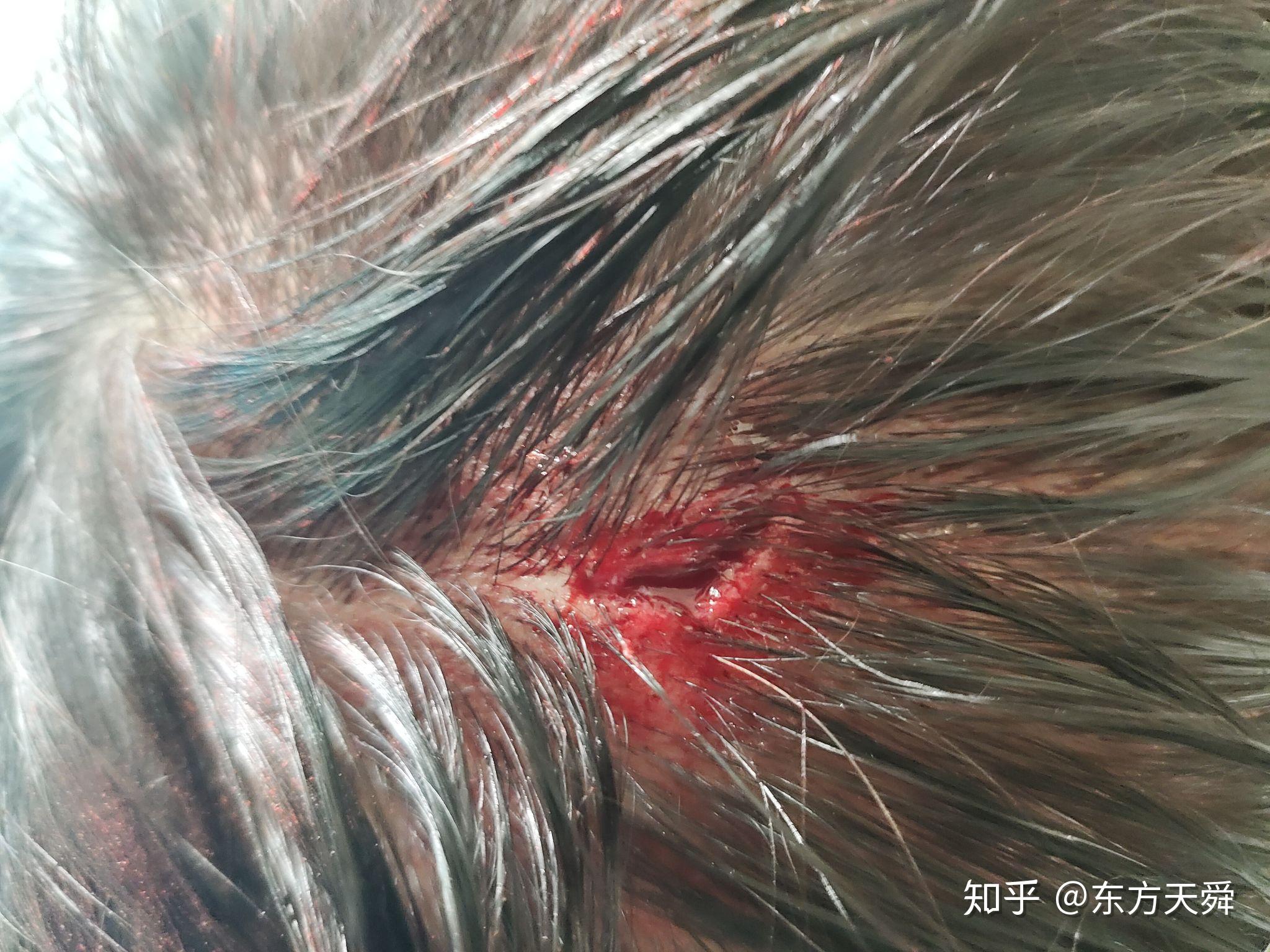 头被砸出血