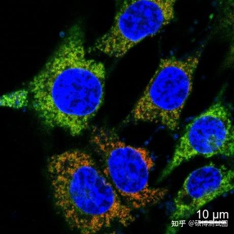 一文读懂激光共聚焦显微镜(lscm)!