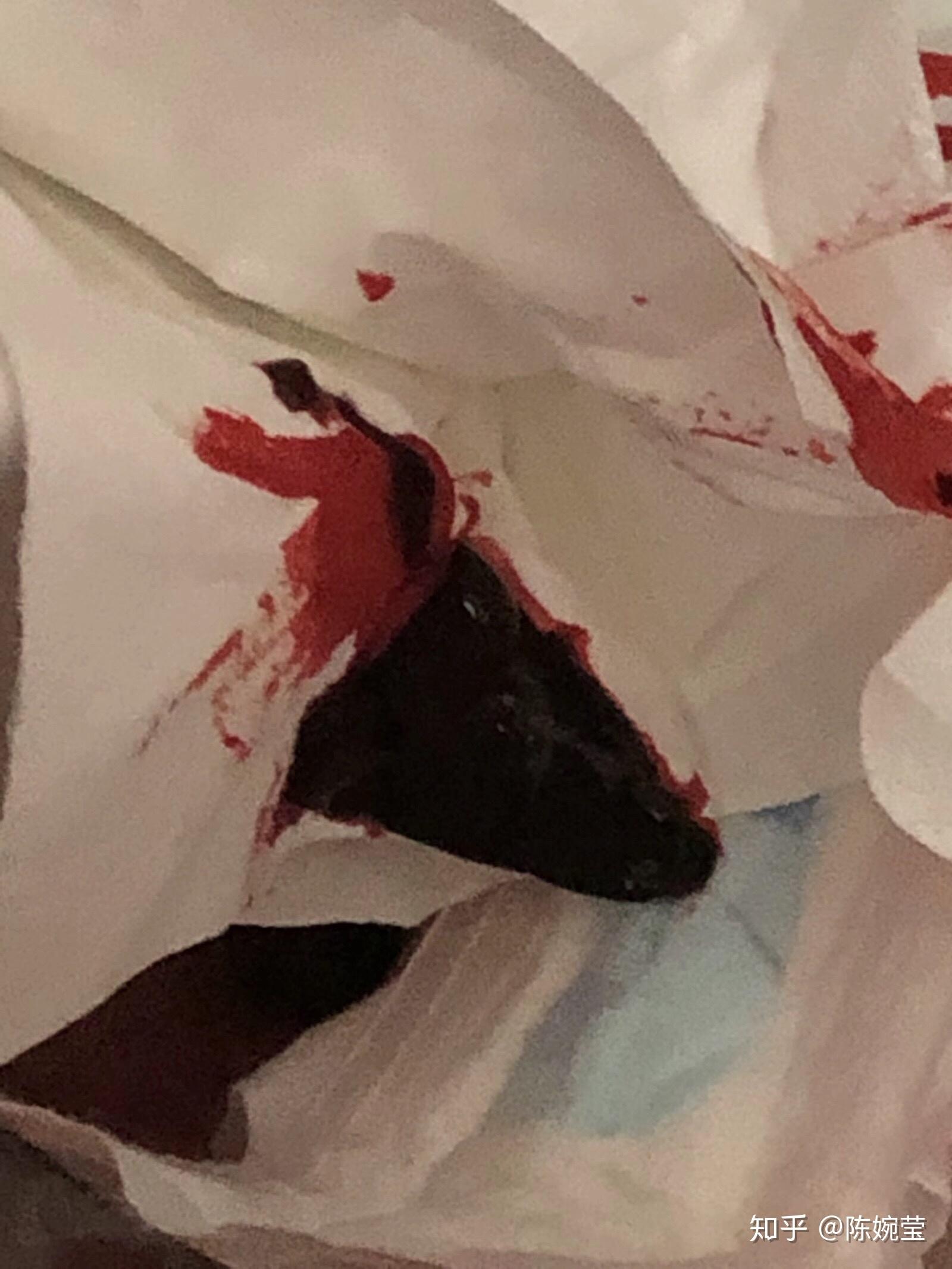 流产在地上血的照片图片