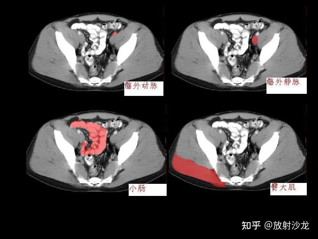 图6-3 经食管腹部的横断层-基础医学-医学