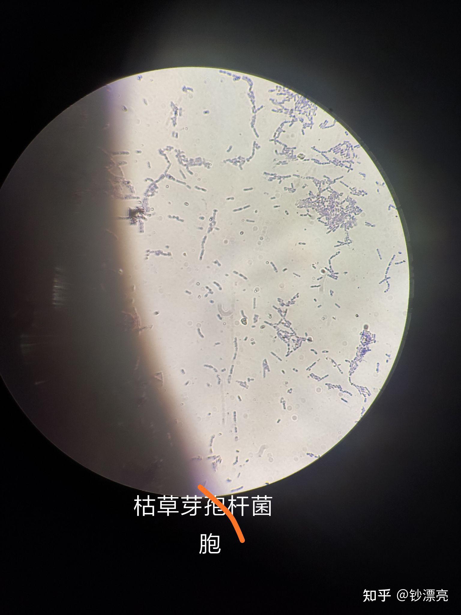 Clostridium Gram Stain