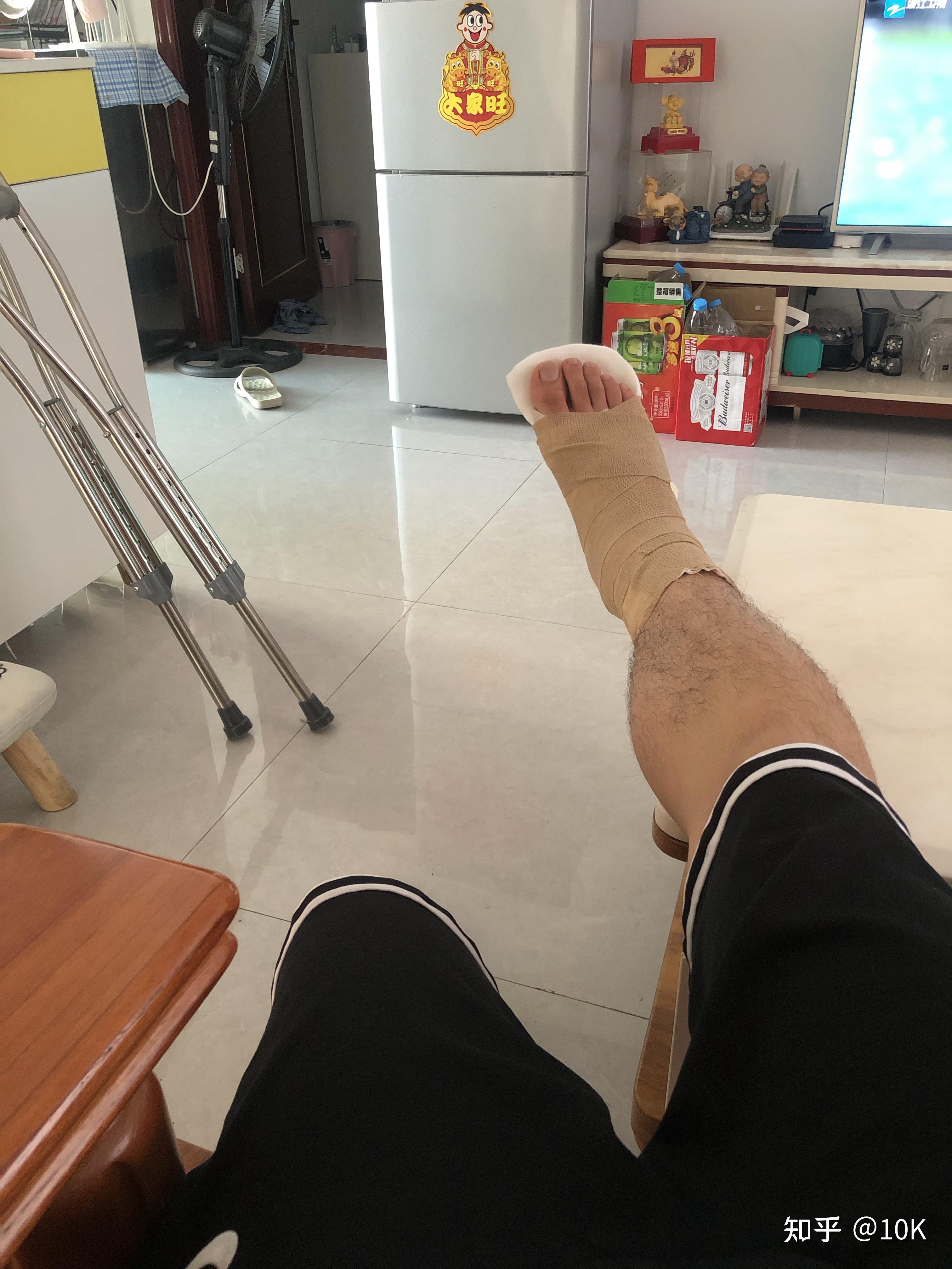 第五跖骨骨折记录
