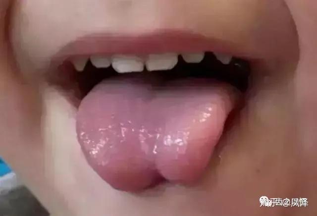 卷舌音和舌腭音发音困难,例如在发 l,r,t d,n,th,sh和z的音时,会不